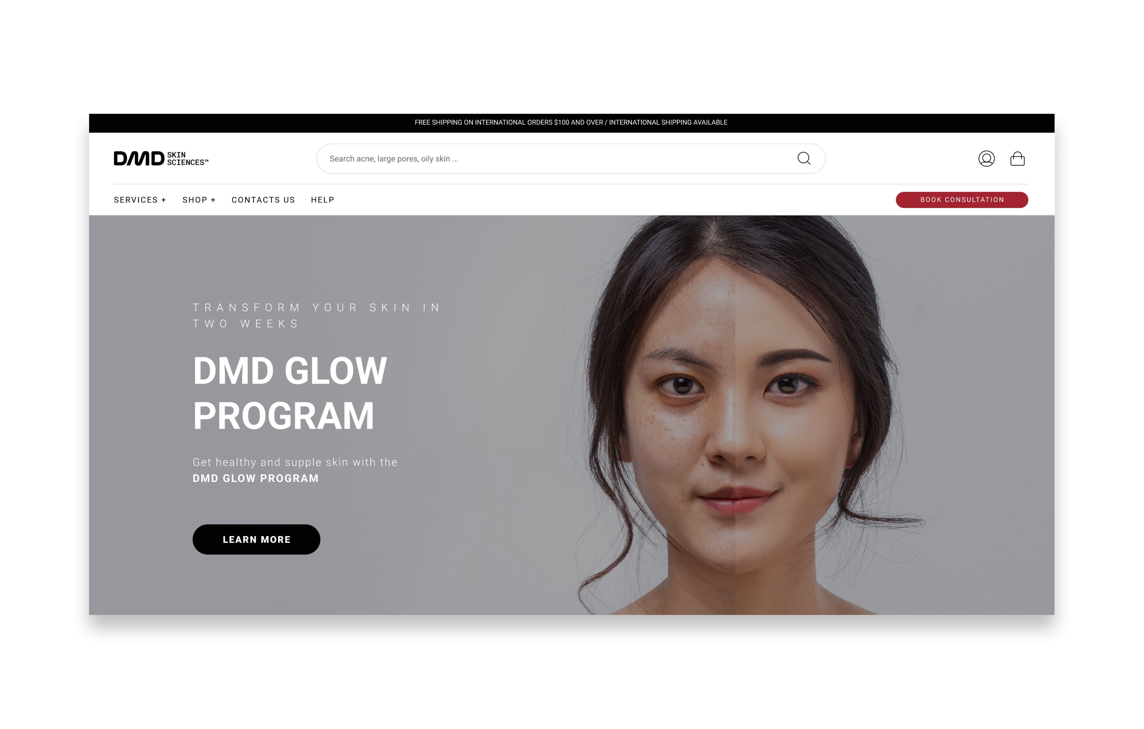 DMD Skin Sciences project image 5